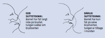Tegning af god og dårlig sutteteknik